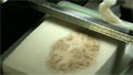 Dissecting the brain of an amnesiac