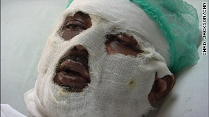 Waqar Khalid, 24, lies in a hospital four days after a suicide bombing wounded him at a Pakistan university.