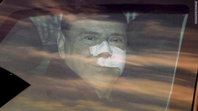 Italys Berlusconi Released From Hospital 5437