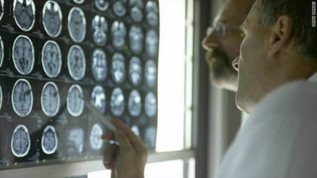 Researchers may have found very early signs of Alzheimer's in healthy elderly individuals with a brain scan method.