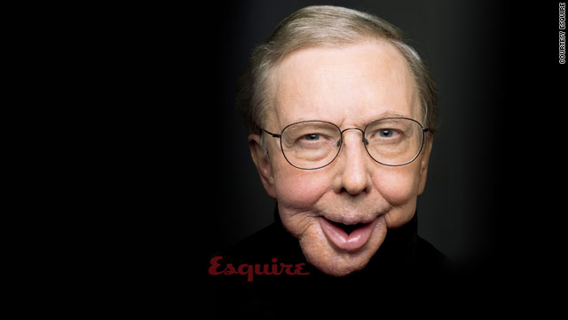 Film critic Roger Ebert lost his jaws to complications from a head and neck cancer.
