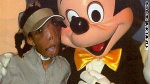 Post-surgery, Marlie Casseus celebrates with Mickey Mouse.