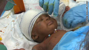 This infant was rescued from the rubble left by the earthquake in Haiti and taken to Miami for medical care.