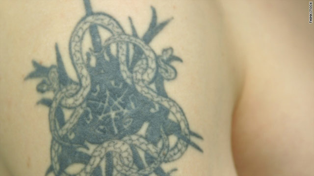 How to safely get a tattoo removed - CNN.com