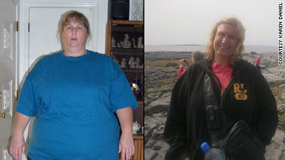 After losing 175 pounds, more challenges