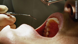 Some experts say mercury from fillings damages cells, especially in the brain, bones and kidneys.