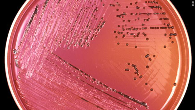 Salmonella bacteria like these have sickened nearly 100 people in the current outbreaks.