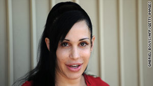 The birth of Nadya Suleman's octuplets last year caused a media firestorm. Now her doctor faces a license hearing.