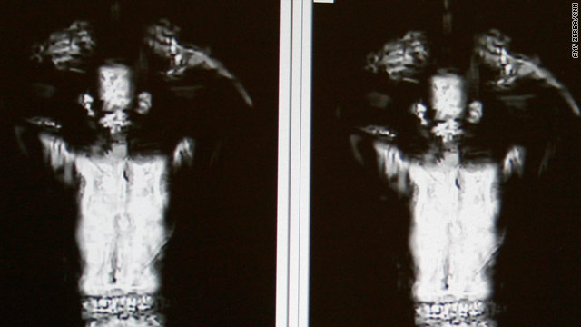 t1larg.body.scan.xray.cnn.jpg