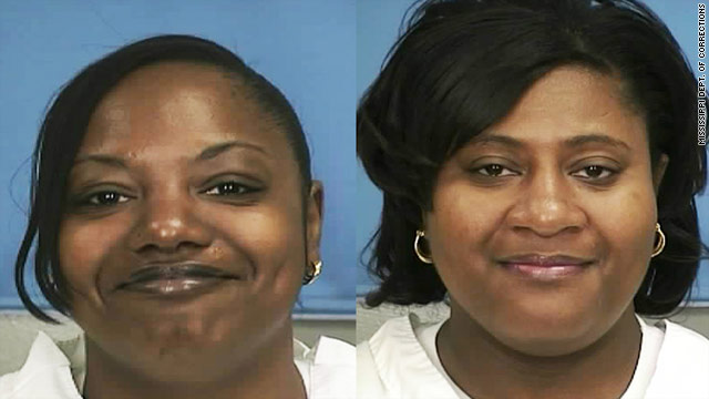 t1larg.kidney.mississippi.mdoc.jpg