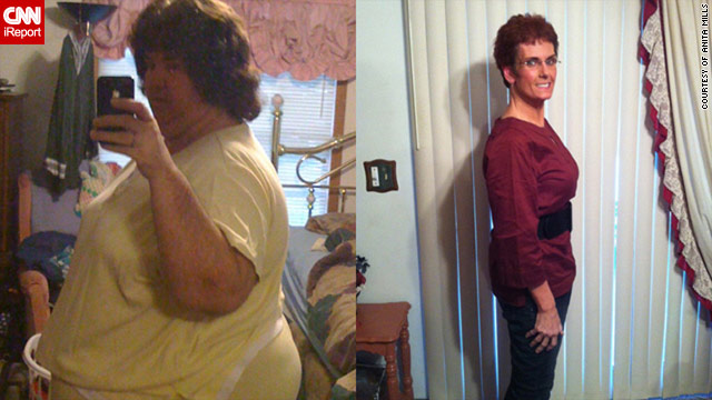 Anita Mills, before and after, losing 232 pounds without crazy diets or extreme exercise trends.