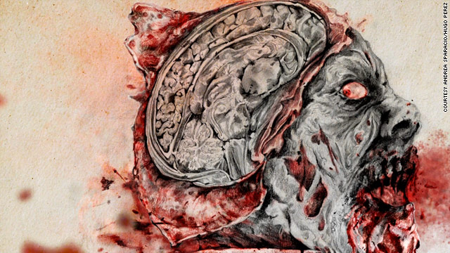 In "The Zombie Autopsies," Dr. Steven Schlozman imagines a virus that strips the brain down to its basest levels.