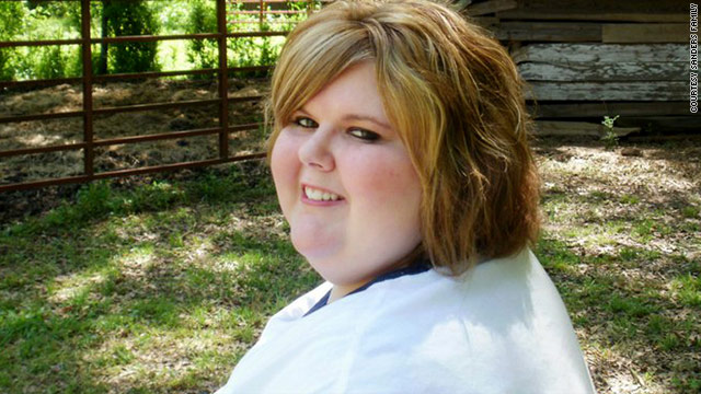 Brandy Sanders, 19, who once weighed 383 pounds, has lost 33 pounds since her surgery in February.