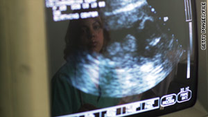 A Texas abortion law, effective September 1, will require women to undergo an ultrasound before obtaining an abortion.