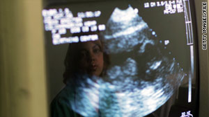 Voters in Mississippi will be given a chance to decide whether life begins at conception.