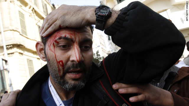 Injured Associated Press photographer Khalil Hamra is pictured during clashes in Cairo's Tahrir square on February 3.