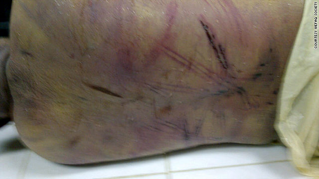 Nabeel Rajab is accused of fabricating this photo of Isa Saquer, who was reportedly tortured and killed in police custody.