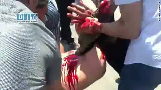 An image from Sham SNN, a Syrian opposition web channel, shows a wounded anti-government protester in Al-Keswa Friday.