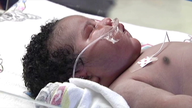 How does a newborn get to 16 pounds? - The Chart - CNN.com ...