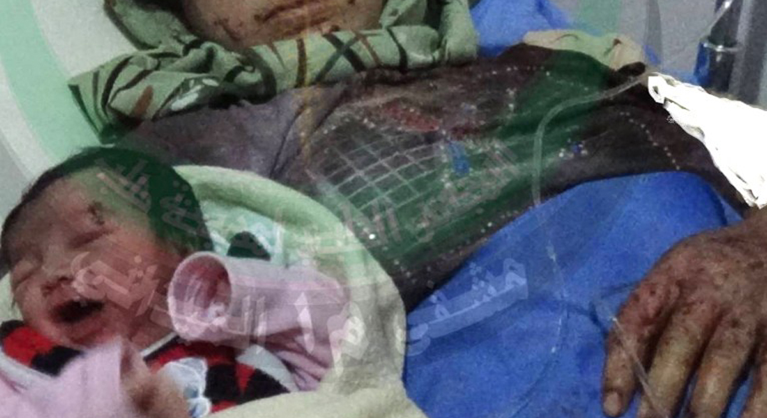 أمل  سوريا ضحية منذ الولادة.. طفلة تولد بشظية على جبهتها - CNNArabic.com