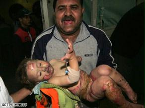 الأطفال ضحايا القصف الإسرائيلي