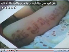 صورة للآيات كما ظهرت في تسجيل للتلفزيون الروسي على جسد الطفل