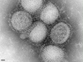 الفيروس الجديد يصيب البشر والطيور ويختلف عن الفيروس الذي يصيب الخنازيرن وفقاً للوزير المصري