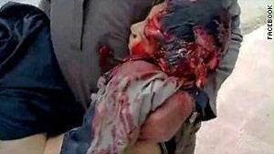 صورة نشرها مشاركون وزعموا أنها لطفل قتل بالأحداث في سوريا