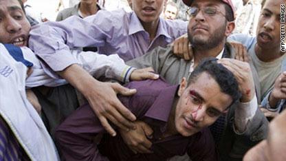 أحد المصابين خلال الاشتباكات بين مؤيدي ومعارضي نظام الحكم في اليمن