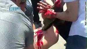 صورة من تسجيل عرضته مواقع للمعارضة السورية تظهر أحد المحتجين وقد أصيب برصاصة في الكسوة قرب دمشق