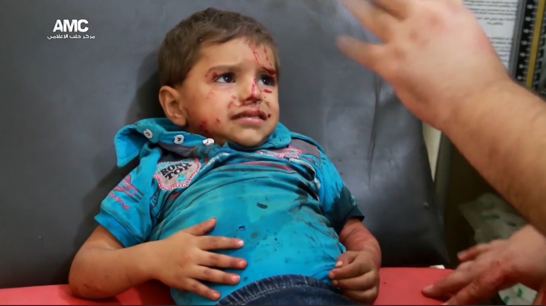 حلب تنزف.. والمجتمع الدولي يصعّد التوتر دون حل
