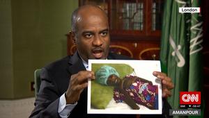 عسيري يرد لـCNN على صورة من "مجاعة اليمن"