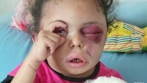 بثينة تفتح عيون العالم على الصراع اليمني