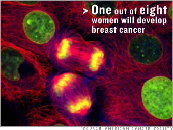 Be vigilant about breast cancer